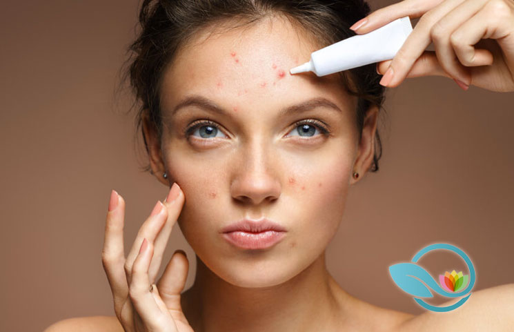 Top Acne Treatments: Find the Best Skin Care Products and Systems Available