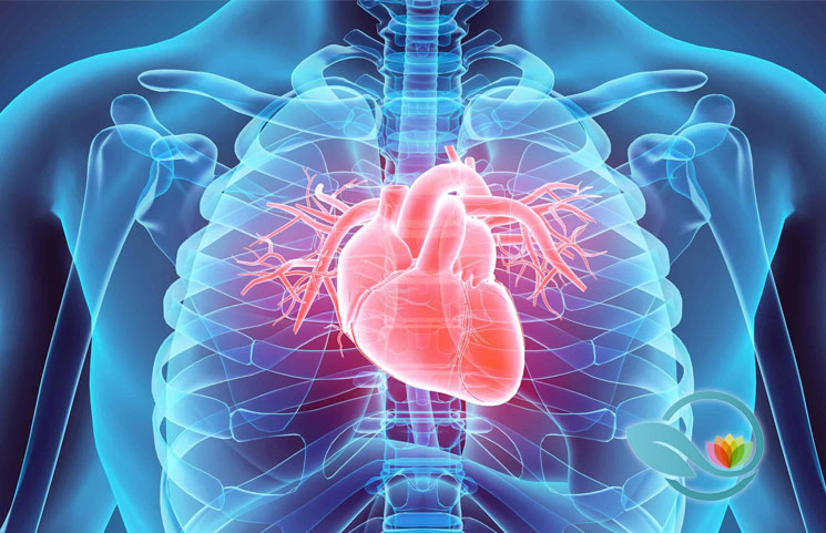 Cardiovascular Disease is America's Primary Health Threat: A Look at Arterial Plaque (Atherosclerosis)