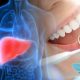 Study Shows Optimal Oral Hygiene of Teeth and Gums Can Reduce Odds of Liver Cancer