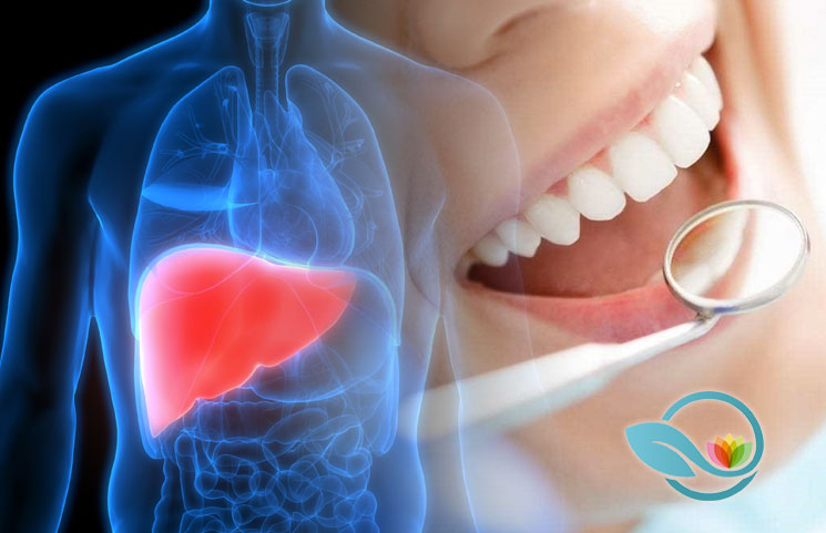 Study Shows Optimal Oral Hygiene of Teeth and Gums Can Reduce Odds of Liver Cancer