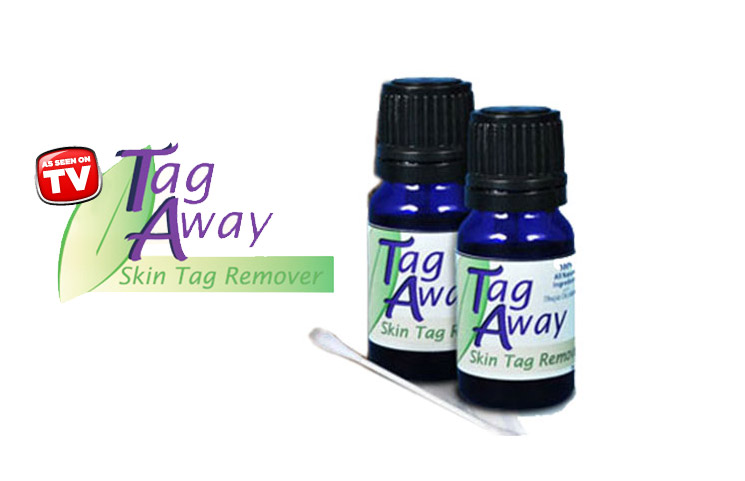 Tag Away: Is Tag Away the Ultimate Skin Tag Removal Solution?